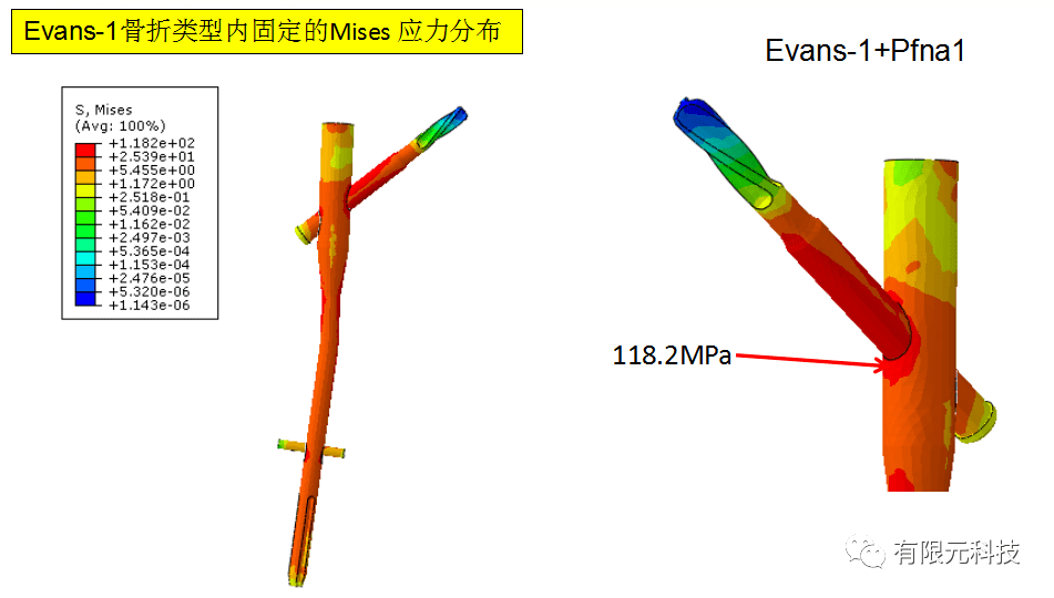 可以拟实建立三维人体骨骼,肌肉,血管等器官组织,并模拟其生物力学