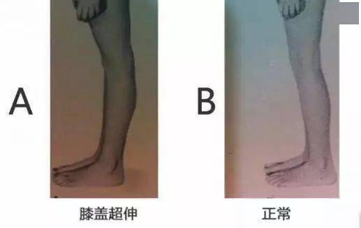 锻炼|赵丽颖再上热搜，锻炼生图线条感十足！更抓眼球的，是女神绝美的体态！