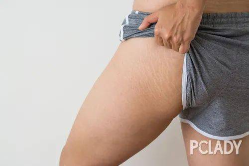 Venus|别只照顾脸，小心身体肌肤让你看起来老十岁！