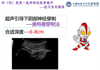 阴部|和（何）亮亮一起学超声技巧系列：超声引导阴部神经阻滞