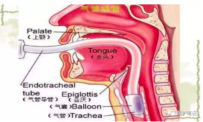 怎么知道自己是哪一种类型痔疮 ceaf0d12c563434ebe29ab796f56aa31.png