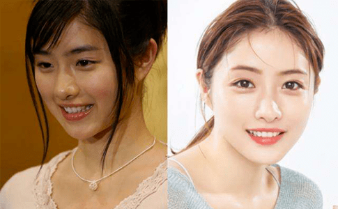 亚洲|日本女生是亚洲第一白没错了！看33岁石原里美、51岁“不老仙妻”就知道......