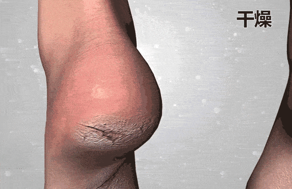 1天只花3毛钱,干裂,脱皮,老茧全消失!效果堪称