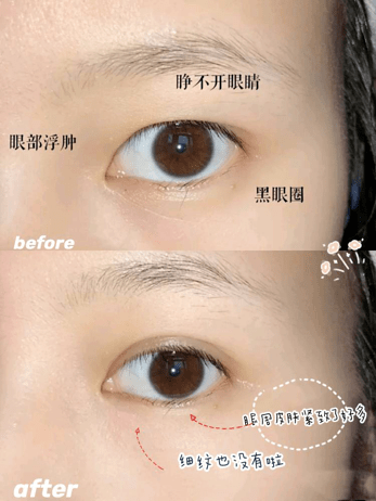 近照|曾经红极一时的“最美港姐”近照曝光，原来美人真的能被一个细节毁掉.......