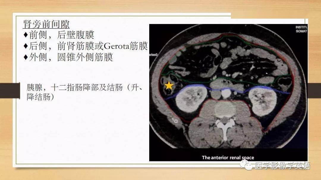 常见原发性腹膜后肿瘤影像诊断及鉴别诊断_手机搜狐网