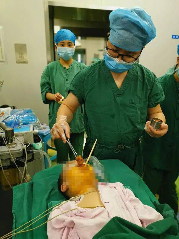 河池1岁多幼童被筷子插入喉咙