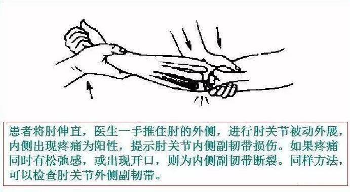冈上肌断裂检查患肢肘关节屈曲9002,前臂置于旋前位,抗阻下用力旋后