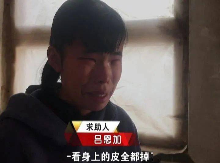 热锅|不偏不倚的坐进滚烫的热锅中......邢台丨天呐！三岁男孩不慎摔倒