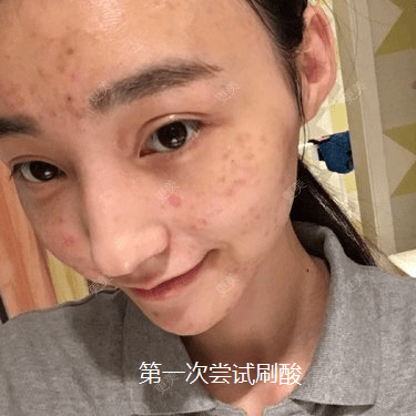 皮肤|杨幂早期合照见心机？看完原图呆了，她们这么早竟都整了...