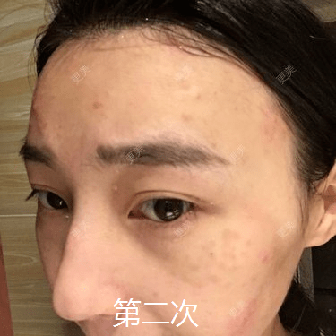 皮肤|杨幂早期合照见心机？看完原图呆了，她们这么早竟都整了...
