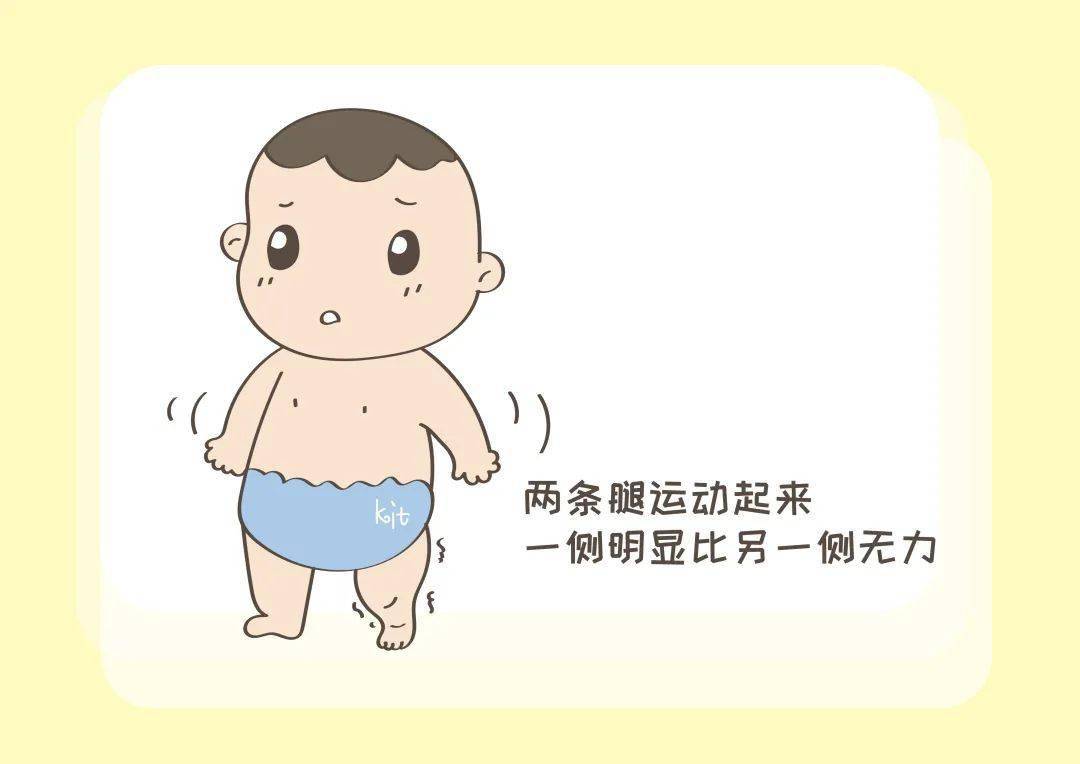 宝宝的大腿纹为啥不对称?这是什么情况?带你一起了解下