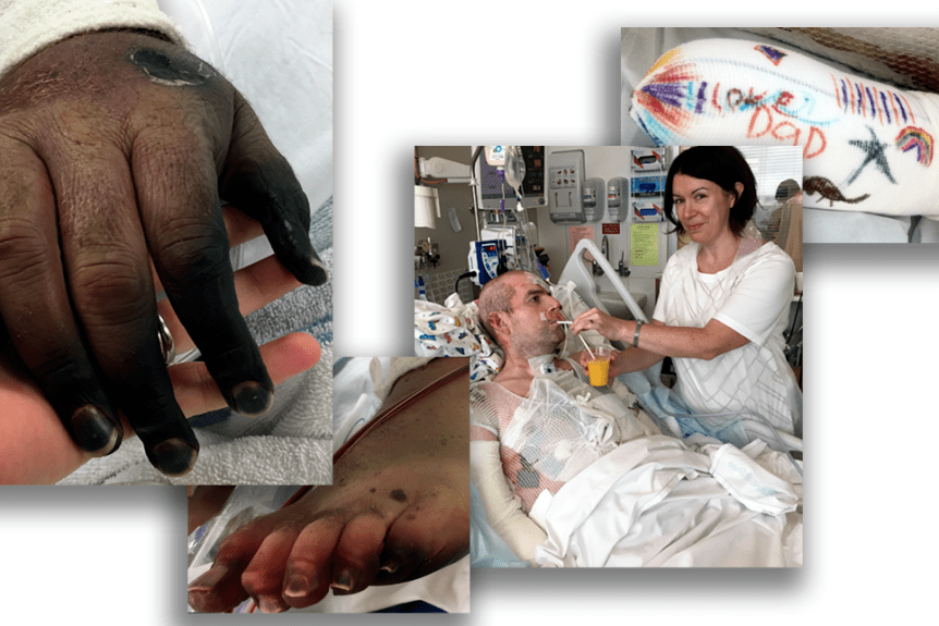 每年1100万人死于这种病澳洲爸爸因为它双手双脚惨被截肢但很多人竟不