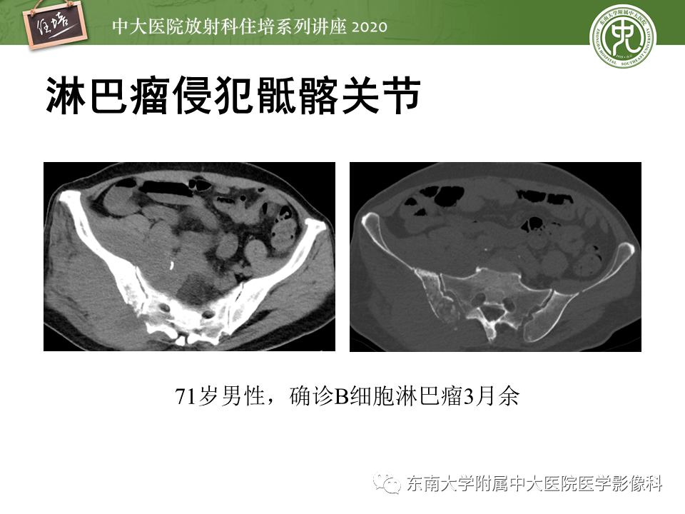 98732aef65c549ca9cc626caec8de1ad.png