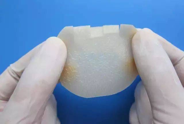 泡沫敷料怎么用