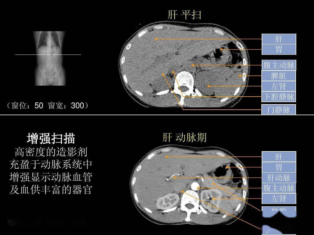 ct运用什么原理_正常肺部ct图(2)