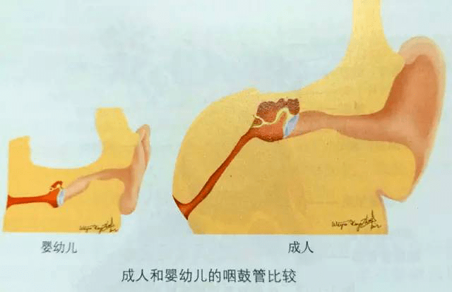 成人口膜炎(3)