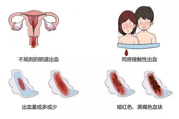 月经血有可能伴有子宫内膜出血时间一般3-7天与平素月经量相同出血量