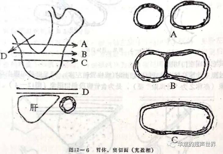 旧文分享:消化道超声检查