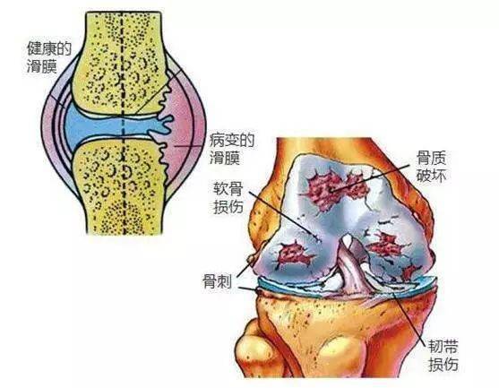 3个动作每天坚持做,保护膝关节,非常