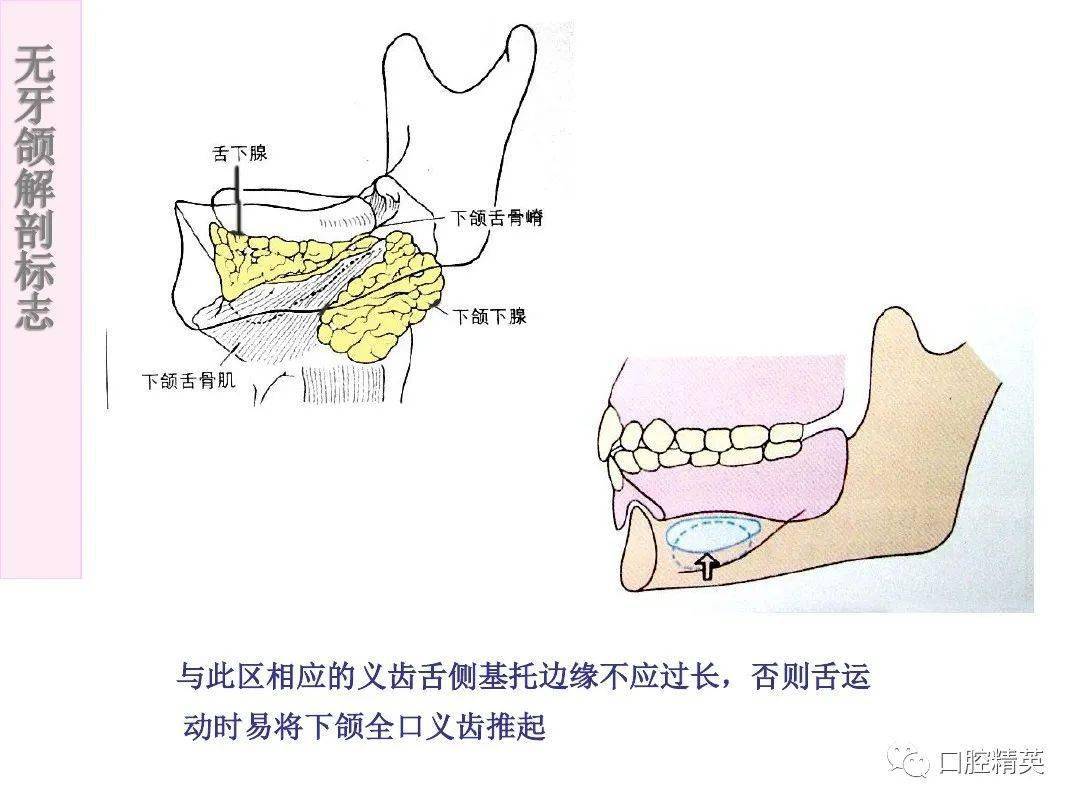 无牙颌解剖标志