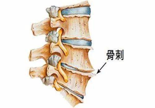 一个强大的方子上治颈椎中治腰椎下治膝盖