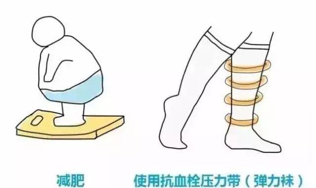 深静脉血栓能致命!这篇静脉血栓防治"大法"你一定要了解