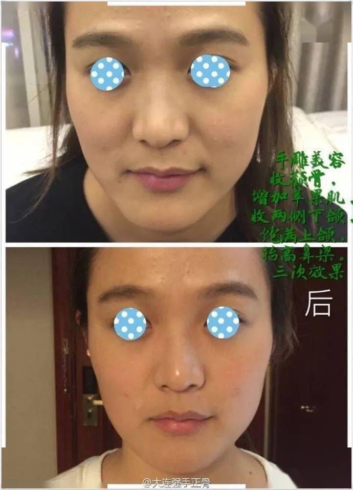 如何让自己的脸变美 92f0aec5bc234bba991a2b9d7d2e61d3.jpeg