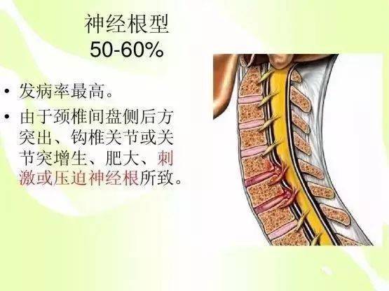 正常的颈椎有八对脊神经,左右各一分支!