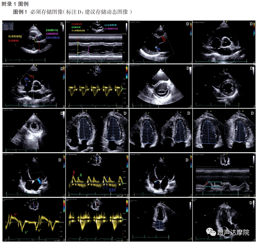中国成人心力衰竭超声心动图规范化检查专家共识