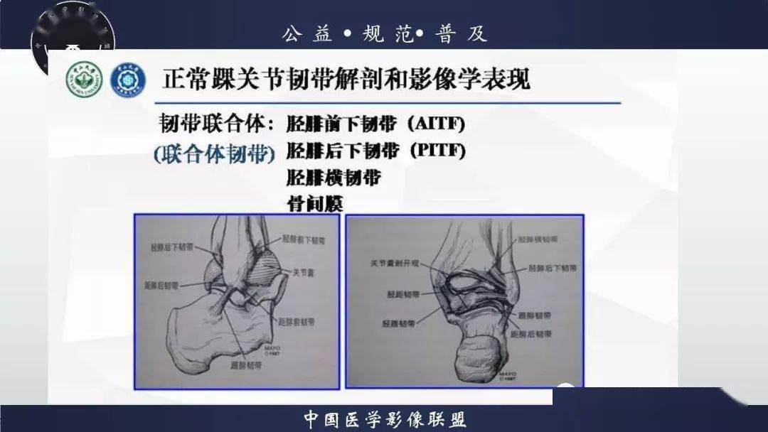 踝关节解剖及损伤mri诊断