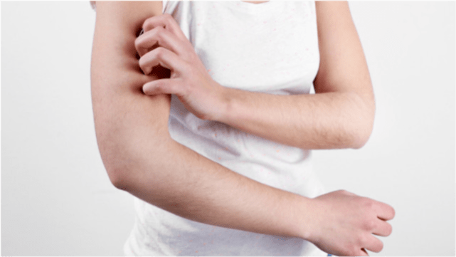 怎样才能让自己的皮肤不发痒 32827aa1742e420e8e957b4c51ce0c32.png