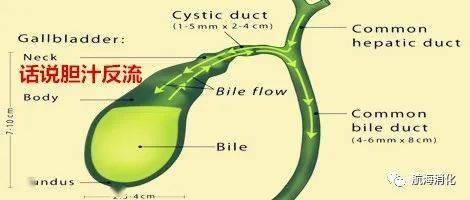 话说胆汁反流
