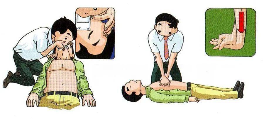 什么情况下需要做心肺复苏 3460f48643da4b0f8f85b3c9fe2a4193.jpeg