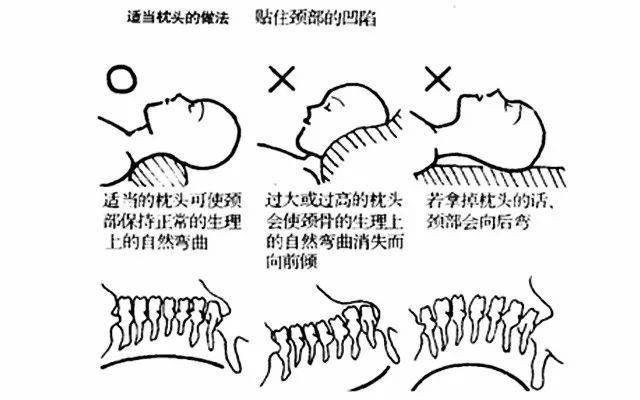 颈部肌肉,  头手对抗操 挺胸收腹下颌微抬,双掌交合扣在枕后骨突出部