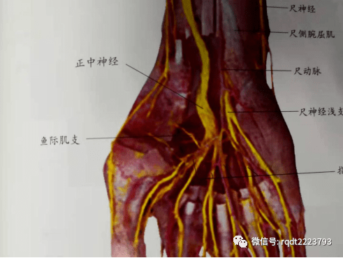 我们先来了解这种病的解剖病理基础,腕管是手腕掌侧一个骨纤维管道,其