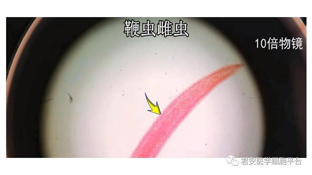 鞭虫及其虫卵美图鉴赏之升级版