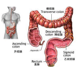 早期结直肠癌的四大"蛛丝马迹"别忽视