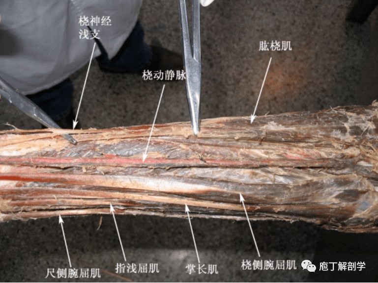 总动脉,经骨间膜近侧缘进入前臂后区,在浅,深层之间伴骨间后神经下行