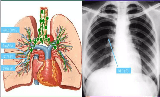 "0"基础小白必备宝典:认识肺部影像结构