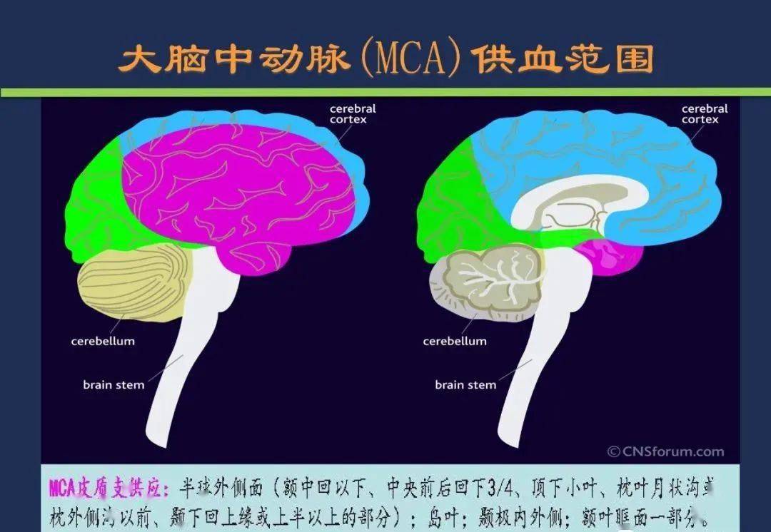 脉络膜前动脉纹状体动脉heubner返动脉大脑前动脉大脑中动脉颈内动脉