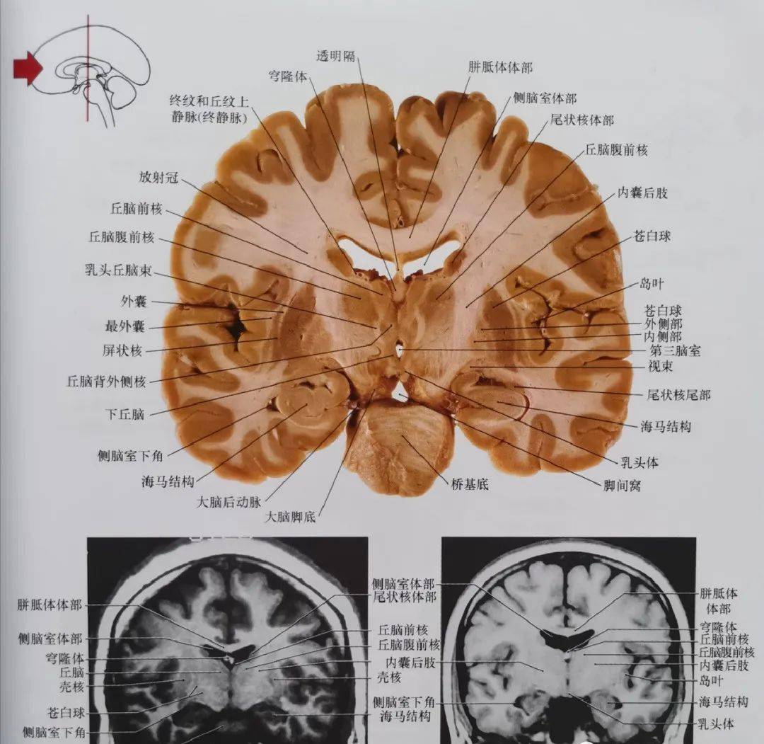 临床神经解剖图谱(断层影像 切片)