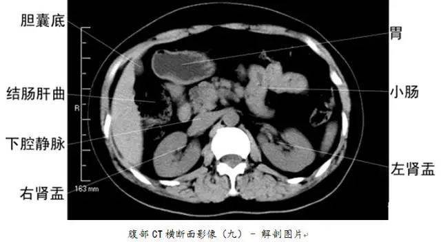 珍藏版 | 全身ct图谱!_解剖