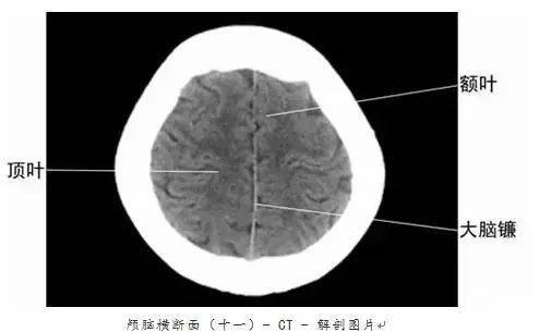 珍藏版 | 全身ct图谱!