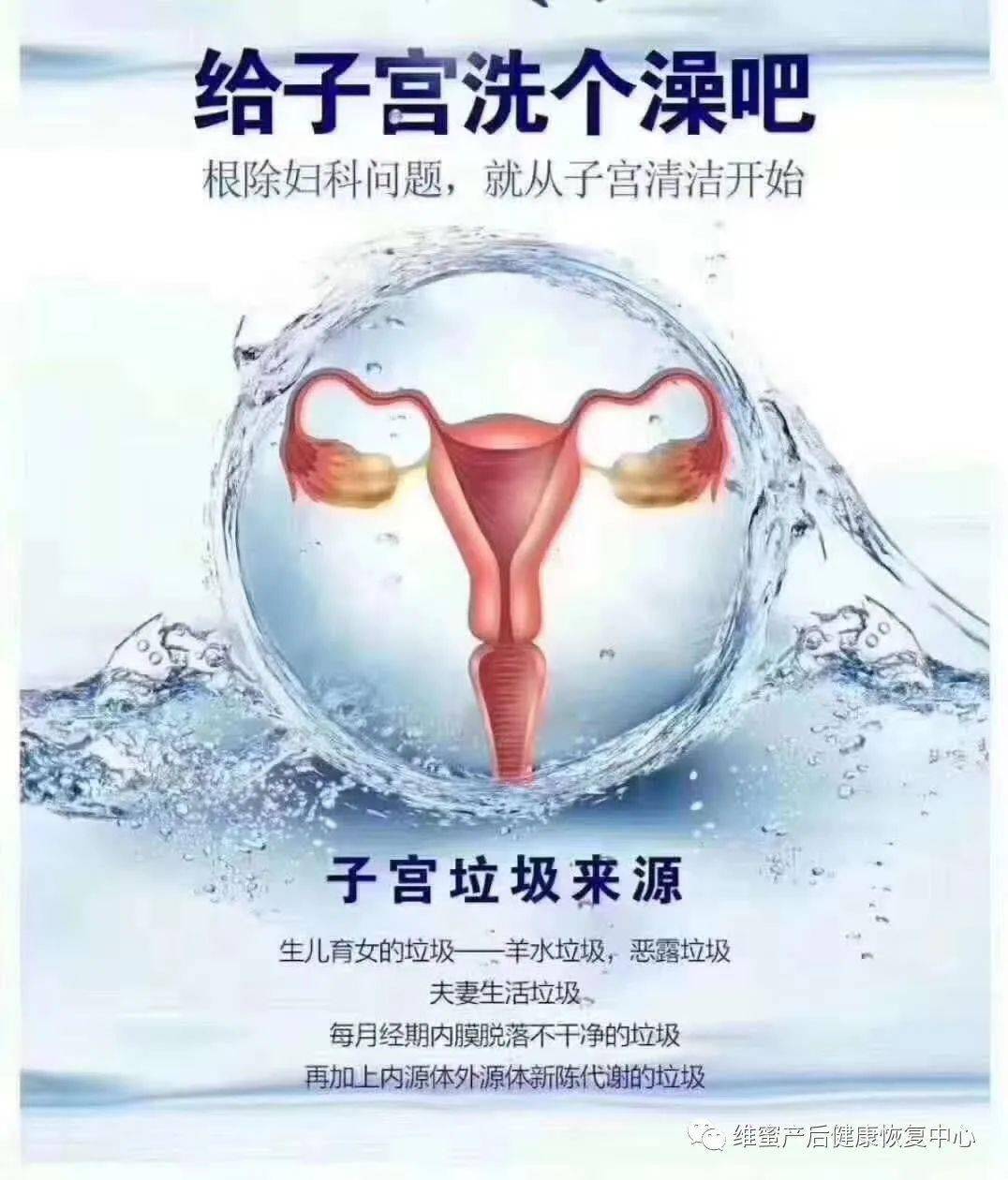 亲子坊维蜜产后关爱女性生殖健康