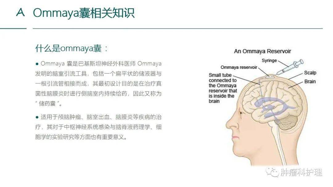 【ppt】一例颅咽管瘤患者的护理查房_ommaya