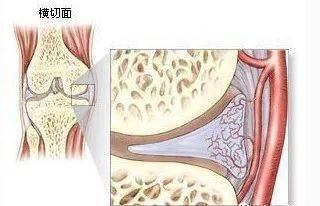 半月板究竟是个啥?