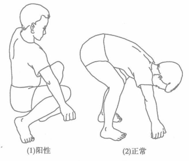 儿童脊柱超伸展试验