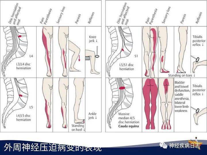 下位脊髓和脊神经定位