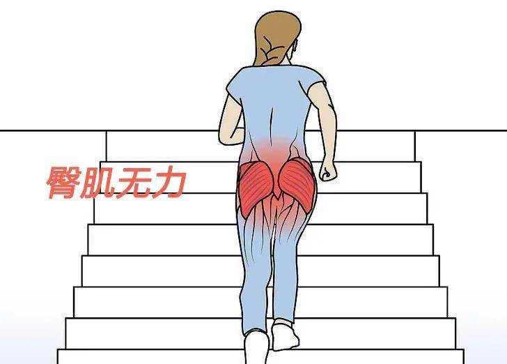 臀肌无力大腿粗好影响美感