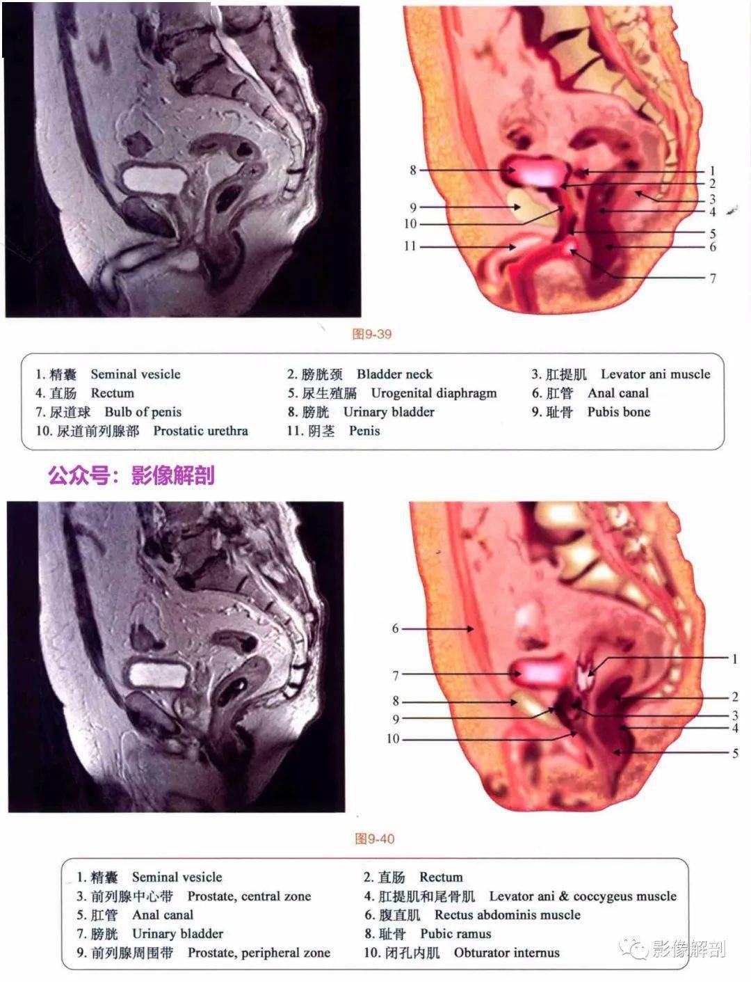 断层图谱 | 男,女性盆腔解剖图谱